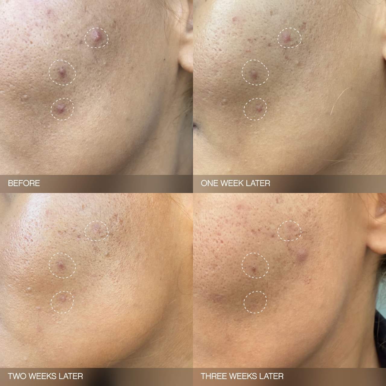 Topicals 
Faded Brightening Bundle for Discoloration on Face & Body (UNSCENTED)